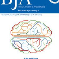 Women in anaesthesia: a scoping review